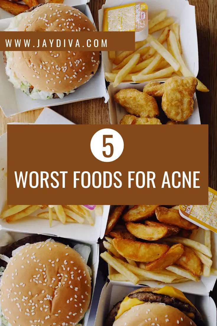 5 worst foods for acne