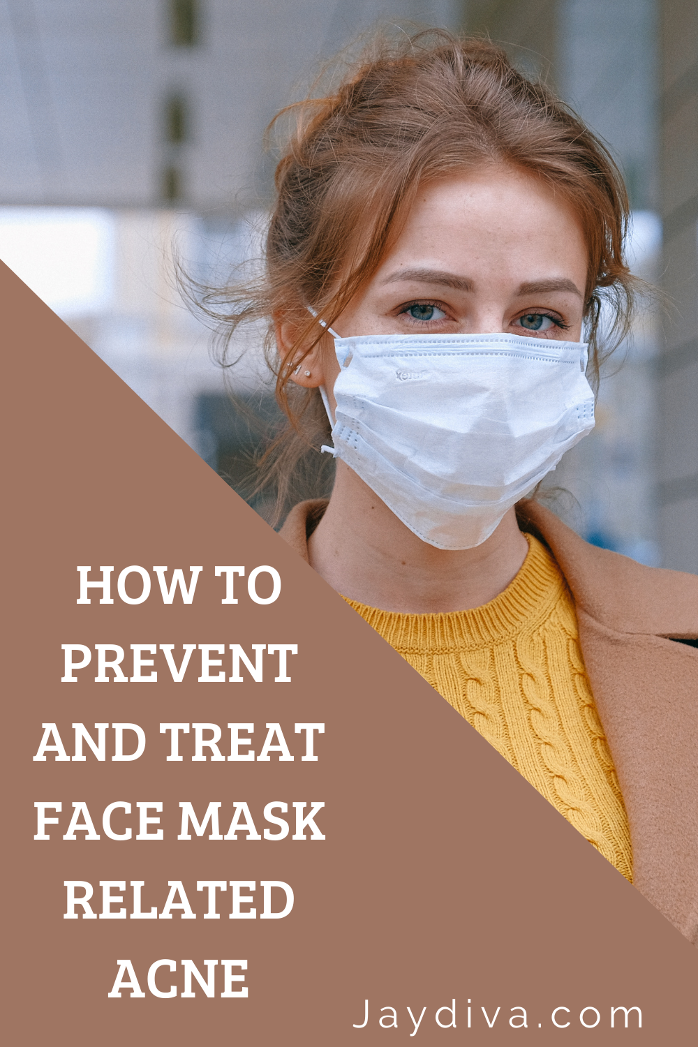 How to treat acne caused by face masks