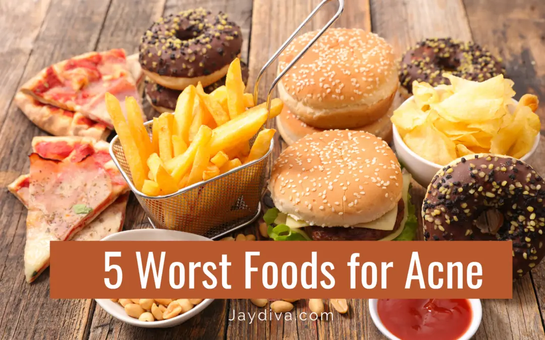 Foods To Avoid For Clear Skin – 5 Worst Foods For Acne