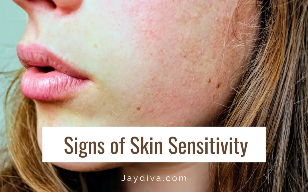 Signs of skin sensitivity