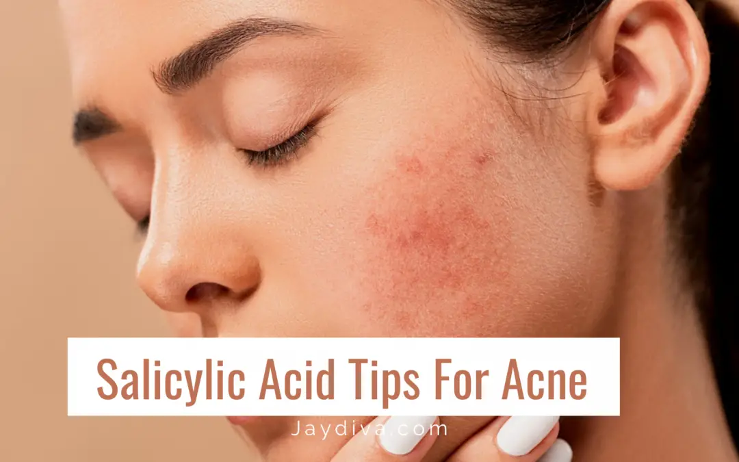 How to Use Salicylic Acid For Acne The Right Way