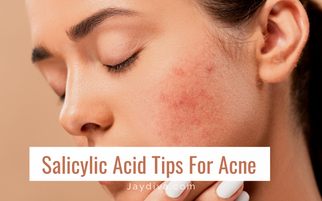 How To Use Salicylic Acid For Acne The Right Way Jaydiva 