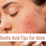 How to use salicylic acid for acne