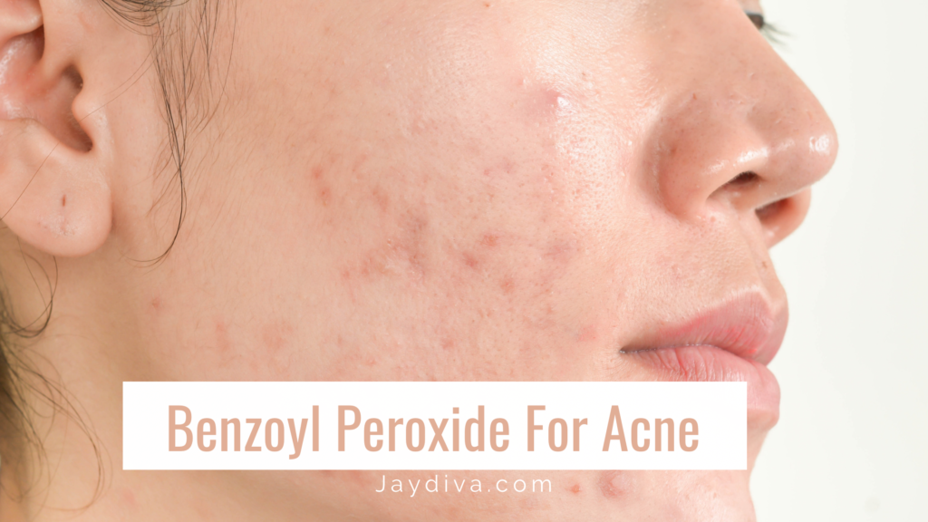 How To Use Benzoyl Peroxide For Acne To See Results Jaydiva