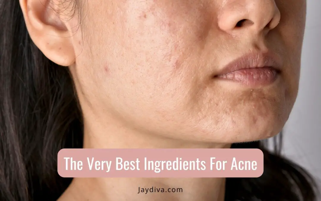 best acne fighting ingredients