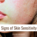 Signs of skin sensitivity
