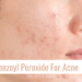 How to use benzoyl peroxide for acne