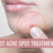 Overnight acne spot treatments