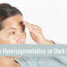 Top 10 skincare ingredients for hyperpigmentation on black skin